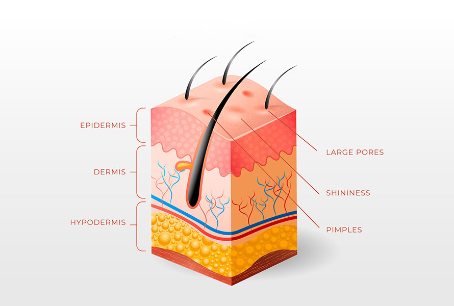 Image of a 3d model
